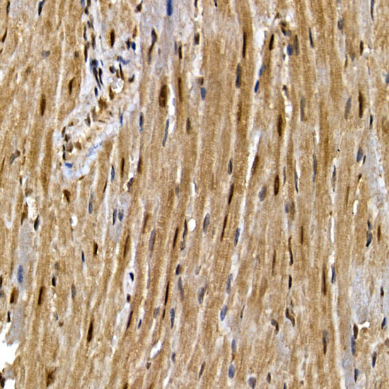 Immunohistochemistry of paraffin-embedded mouse heart using PPARγ Polyclonal Antibody at dilution of 1:200 (40x lens).Perform high pressure antigen retrieval with 10 mM citrate buffer pH 6.0 before commencing with IHC staining protocol.