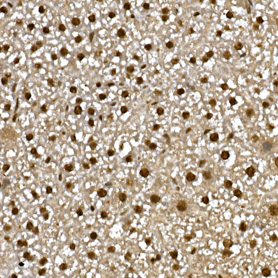 Immunohistochemistry of paraffin-embedded mouse liver using PPARγ Polyclonal Antibody at dilution of 1:200 (40x lens).Perform high pressure antigen retrieval with 10 mM citrate buffer pH 6.0 before commencing with IHC staining protocol.