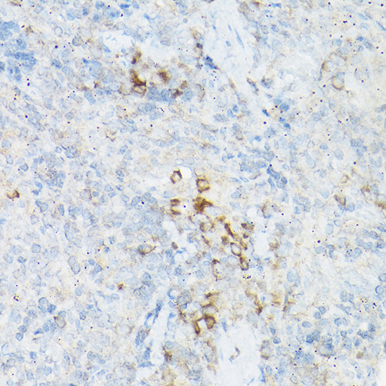 Immunohistochemistry of paraffin-embedded rat spleen using TNF-α Polyclonal antibody at dilution of 1:25 (40x lens).Perform high pressure antigen retrieval with 10 mM citrate buffer pH 6.0 before commencing with IHC staining protocol.
