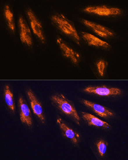 Immunofluorescence analysis of H9C2 cells using NMDAR2A Polyclonal Antibody at dilution of 1:100. Blue: DAPI for nuclear staining.