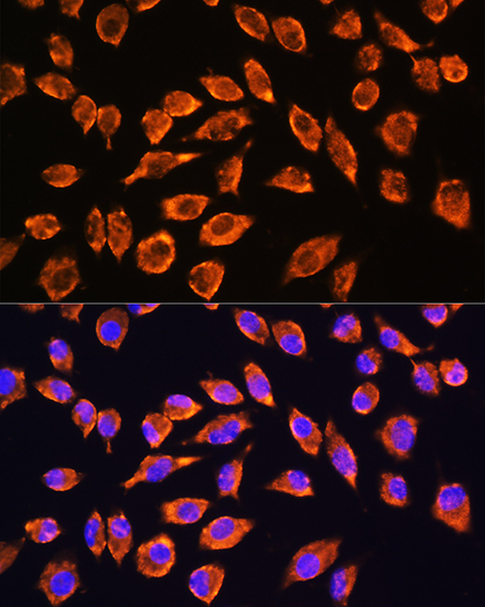 Immunofluorescence analysis of L929 cells using NMDAR2A Polyclonal antibody at dilution of 1:100. Blue: DAPI for nuclear staining.