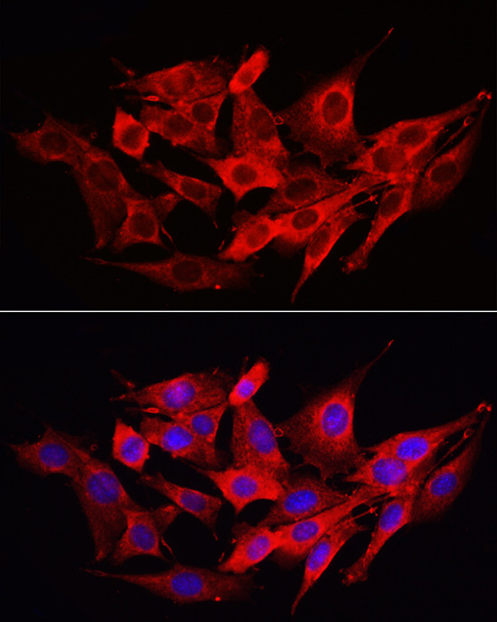 Immunofluorescence analysis of NIH/3T3 cells using Caspase-1 Polyclonal Antibody at dilution of 1:200 (40x lens). Blue: DAPI for nuclear staining.