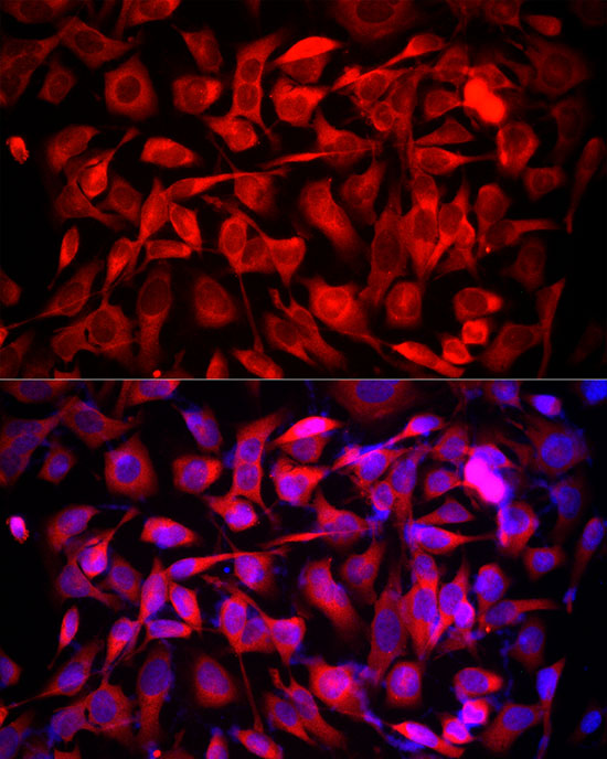 Immunofluorescence analysis of HeLa cells using MTAP Polyclonal antibody at dilution of 1:50 (40x lens). Blue: DAPI for nuclear staining.