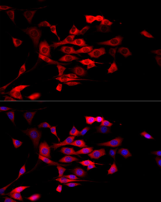 Immunofluorescence analysis of NIH/3T3 cells using MTAP Polyclonal antibody at dilution of 1:50 (40x lens). Blue: DAPI for nuclear staining.