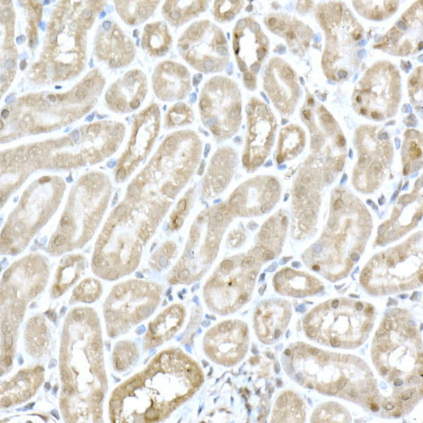 Immunohistochemistry of paraffin-embedded mouse kidney using MTAP Polyclonal antibody at dilution of 1:50 (40x lens).Perform high pressure antigen retrieval with 10 mM citrate buffer pH 6.0 before commencing with IHC staining protocol.