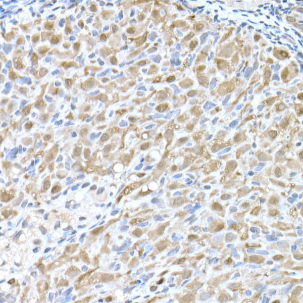 Immunohistochemistry of paraffin-embedded rat ovary using MTAP Polyclonal antibody at dilution of 1:50 (40x lens).Perform high pressure antigen retrieval with 10 mM citrate buffer pH 6.0 before commencing with IHC staining protocol.