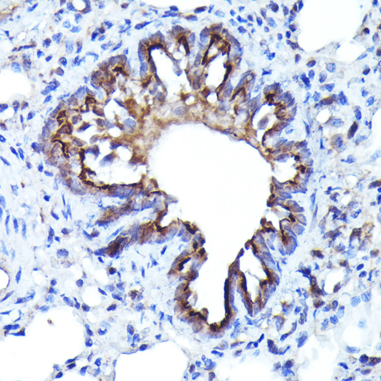 Immunohistochemistry of paraffin-embedded rat lung using LGR5/GPR49 Polyclonal antibody at dilution of 1:300 (40x lens).Perform high pressure antigen retrieval with 10 mM citrate buffer pH 6.0 before commencing with IHC staining protocol.