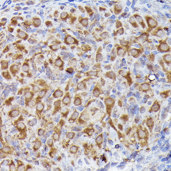 Immunohistochemistry of paraffin-embedded rat ovary using LGR5/GPR49 Polyclonal antibody at dilution of 1:300 (40x lens).Perform high pressure antigen retrieval with 10 mM citrate buffer pH 6.0 before commencing with IHC staining protocol.