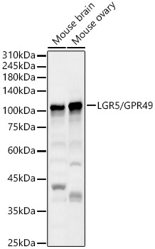 Western blot analysis of various lysates using LGR5/GPR49 Polyclonal Antibody at 1:500 dilution.