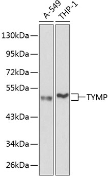 Western blot analysis of extracts of various cell lines using TYMP Polyclonal Antibody at 1:1000 dilution.