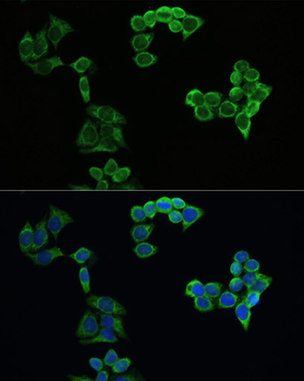 Immunofluorescence analysis of HeLa cells using APP Polyclonal Antibody at dilution of 1:100. Blue: DAPI for nuclear staining.