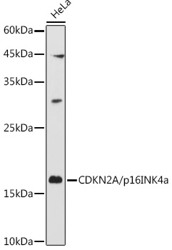 Western blot analysis of extracts of HeLa cells using CDKN2A/p16INK4a Polyclonal Antibody at 1:1000 dilution.