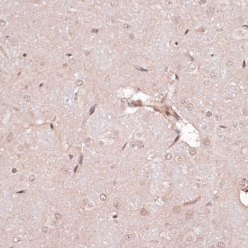 Immunohistochemistry of paraffin-embedded rat brain using CREB1 Polyclonal Antibody at dilution of 1:100 (40x lens).Perform microwave antigen retrieval with 10 mM PBS buffer pH 7.2 before commencing with IHC staining protocol.