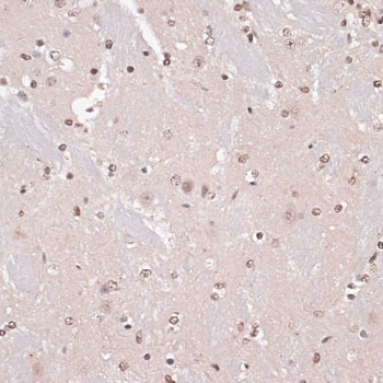 Immunohistochemistry of paraffin-embedded mouse brain using CREB1 Polyclonal antibody at dilution of 1:100 (40x lens).Perform microwave antigen retrieval with 10 mM PBS buffer pH 7.2 before commencing with IHC staining protocol.