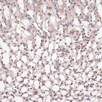 Immunohistochemistry of paraffin-embedded mouse kidney using CREB1 Polyclonal antibody at dilution of 1:100 (40x lens).Perform microwave antigen retrieval with 10 mM PBS buffer pH 7.2 before commencing with IHC staining protocol.