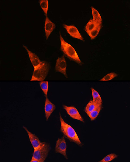 Immunofluorescence analysis of HepG2 using TLR4 Polyclonal Antibody at dilution of 1 : 200 (40x lens). Blue: DAPI for nuclear staining.