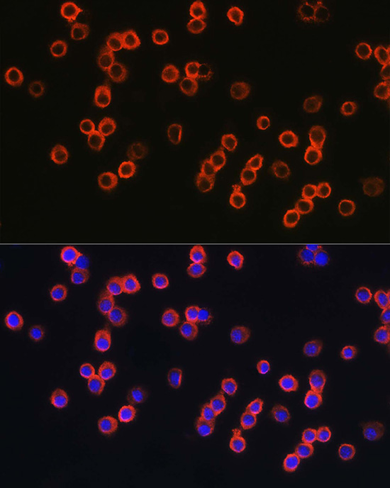 Immunofluorescence analysis of RAW264.7 using TLR4 Polyclonal antibody at dilution of 1 : 200 (40x lens). Blue: DAPI for nuclear staining.