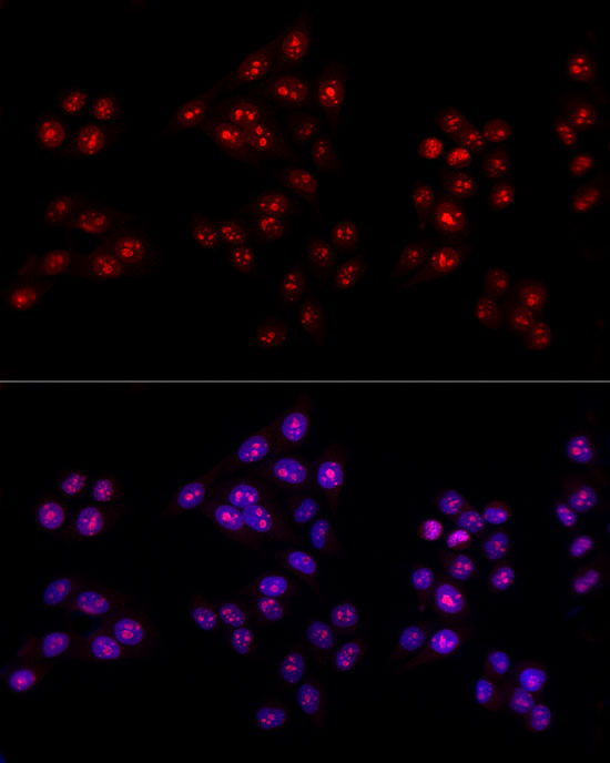 Immunofluorescence analysis of HeLa cells using Ki67 Polyclonal Antibody at dilution of 1:100 (40x lens). Blue: DAPI for nuclear staining.