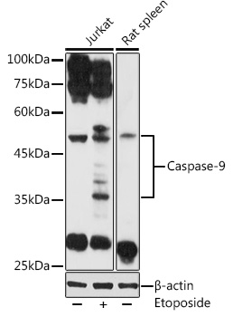 Western blot analysis of extracts of various cell lines using Caspase-9 Polyclonal Antibody at 1:1000 dilution.Jurkat cells were treated by Etoposide (25 uM) at 37℃ for 5 hours.