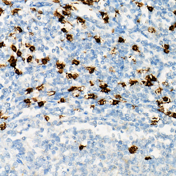 Immunohistochemistry of paraffin-embedded human tonsil using CD8A Polyclonal antibody at dilution of 1:100 (40x lens).