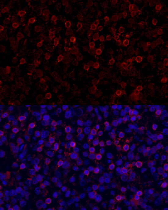 Immunofluorescence analysis of human tonsil cells using PD-1/CD279 Polyclonal Antibody at dilution of 1:150 (40x lens). Blue: DAPI for nuclear staining.