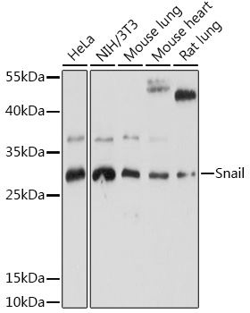 Western blot analysis of extracts of various cell lines using Snail Polyclonal Antibody at 1:1000 dilution.