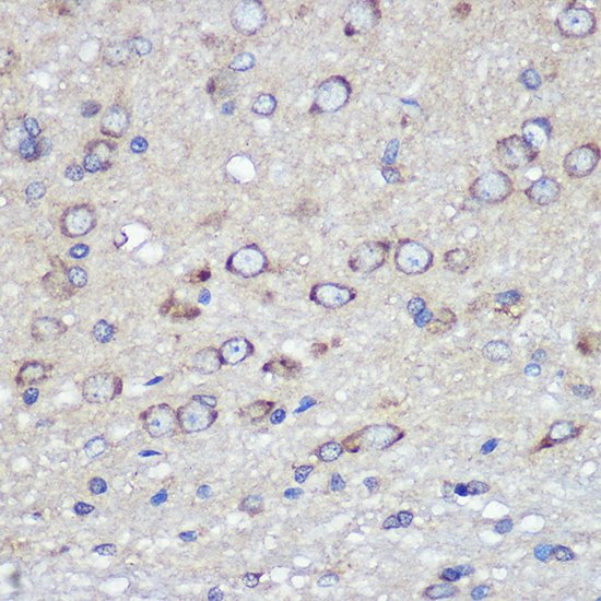 Immunohistochemistry of paraffin-embedded rat brain using JAM-A/CD321/F11R Polyclonal antibody at dilution of 1:100 (40x lens).Perform microwave antigen retrieval with 10 mM PBS buffer pH 7.2 before commencing with IHC staining protocol.