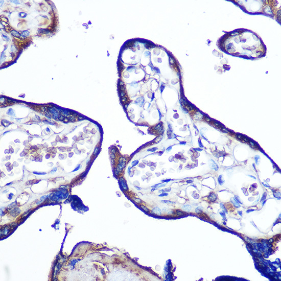 Immunohistochemistry of paraffin-embedded human placenta using JAM-A/CD321/F11R Polyclonal antibody at dilution of 1:100 (40x lens).Perform microwave antigen retrieval with 10 mM PBS buffer pH 7.2 before commencing with IHC staining protocol.