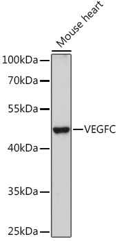 Western blot analysis of extracts of Mouse heart using VEGFC Polyclonal Antibody at 1:1000 dilution.