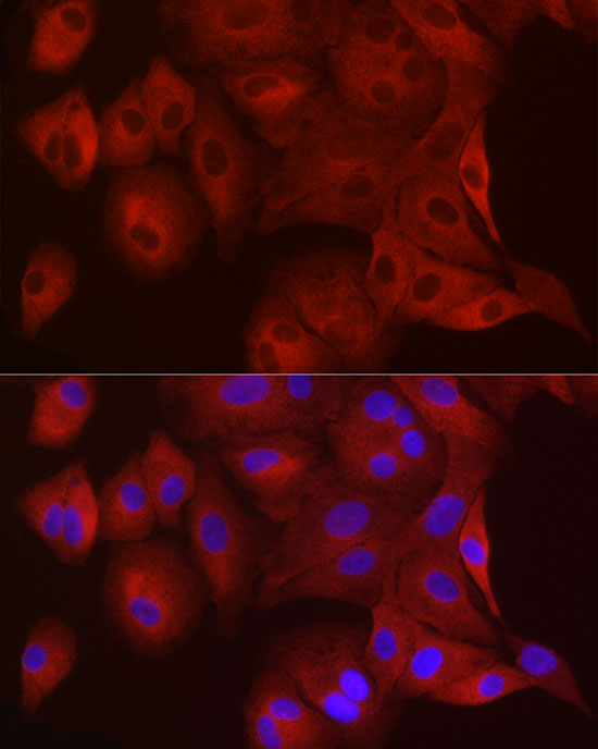 Immunofluorescence analysis of A-549 cells using WISP2 Polyclonal Antibody at dilution of 1:100 (40x lens). Blue: DAPI for nuclear staining.