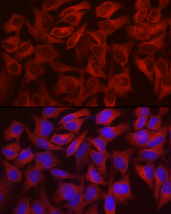 Immunofluorescence analysis of HeLa cells using WISP2 Polyclonal Antibody at dilution of 1:100 (40x lens). Blue: DAPI for nuclear staining.