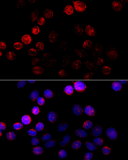 Immunofluorescence analysis of HeLa cells using Aromatase (CYP19A1) Polyclonal antibody at dilution of 1:100 (40x lens). Blue: DAPI for nuclear staining.