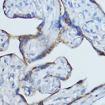 Immunohistochemistry of paraffin-embedded human placenta using Aromatase (CYP19A1) Polyclonal Antibody at dilution of 1:100 (40x lens).Perform microwave antigen retrieval with 10 mM PBS buffer pH 7.2 before commencing with IHC staining protocol.