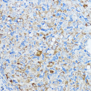 Immunohistochemistry of paraffin-embedded rat ovary using Aromatase (CYP19A1) Polyclonal antibody at dilution of 1:100 (40x lens).Perform microwave antigen retrieval with 10 mM PBS buffer pH 7.2 before commencing with IHC staining protocol.