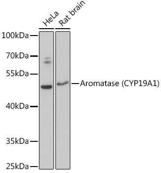 Western blot analysis of extracts of various cell lines using Aromatase (CYP19A1) Polyclonal Antibody at 1:3000 dilution.