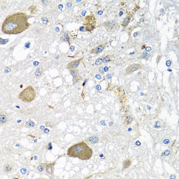 Immunohistochemistry of paraffin-embedded rat brain using IFNL3 Polyclonal Antibody at dilution of 1:100 (40x lens).Perform microwave antigen retrieval with 10 mM PBS buffer pH 7.2 before commencing with IHC staining protocol.