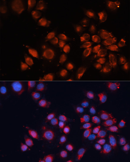 Immunofluorescence analysis of HeLa cells using Cation-independent M6PR (Cation-independent M6PR (IGF2R)) Polyclonal antibody at dilution of 1:100. Blue: DAPI for nuclear staining.