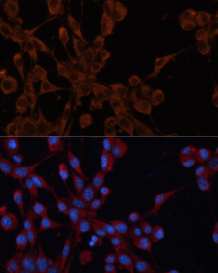 Immunofluorescence analysis of NIH/3T3 cells using Cation-independent M6PR (Cation-independent M6PR (IGF2R)) Polyclonal antibody at dilution of 1:100. Blue: DAPI for nuclear staining.