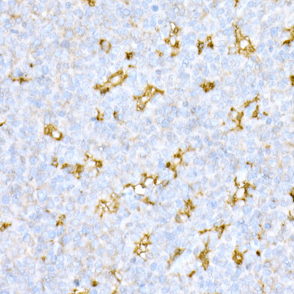 Immunohistochemistry of paraffin-embedded human tonsil using Cathepsin D Polyclonal antibody at dilution of 1:25 (40x lens).Perform high pressure antigen retrieval with 10 mM citrate buffer pH 6.0 before commencing with IHC staining protocol.