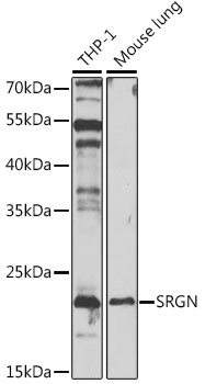 Western blot analysis of extracts of various cell lines using SRGN Polyclonal Antibody at 1:1000 dilution.