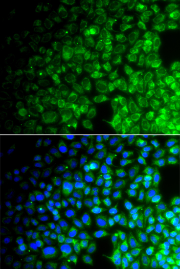 Immunofluorescence analysis of A549 cells using USP10 Polyclonal Antibody Blue: DAPI for nuclear staining.