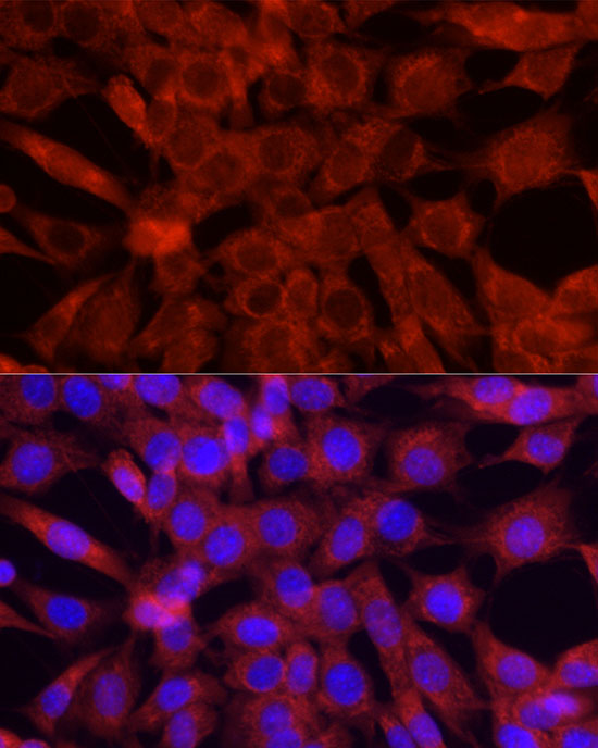 Immunofluorescence analysis of NIH/3T3 cells using Cytochrome C Polyclonal antibodyat dilution of 1:50 (40x lens). Blue: DAPI for nuclear staining.