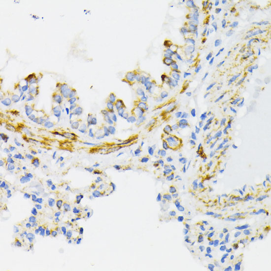 Immunohistochemistry of paraffin-embedded rat lung using Cytochrome C Polyclonal Antibody at dilution of 1:100 (40x lens).Perform microwave antigen retrieval with 10 mM PBS buffer pH 7.2 before commencing with IHC staining protocol.