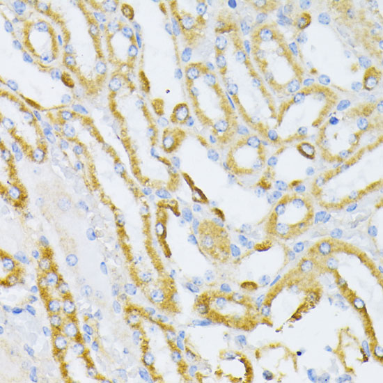 Immunohistochemistry of paraffin-embedded mouse kidney using Cytochrome C Polyclonal antibody at dilution of 1:100 (40x lens).Perform microwave antigen retrieval with 10 mM PBS buffer pH 7.2 before commencing with IHC staining protocol.