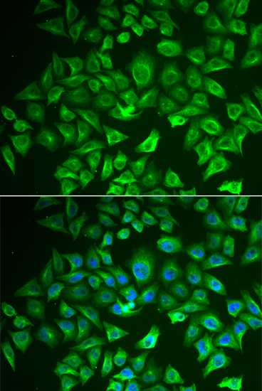 Immunofluorescence analysis of A549 cells using EHHADH Polyclonal Antibody Blue: DAPI for nuclear staining.