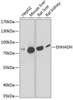 Western blot analysis of extracts of various cell lines using EHHADH Polyclonal Antibody at 1:1000 dilution.