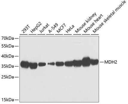 Western blot analysis of extracts of various cell lines using MDH2 Polyclonal Antibody at 1:1000 dilution.