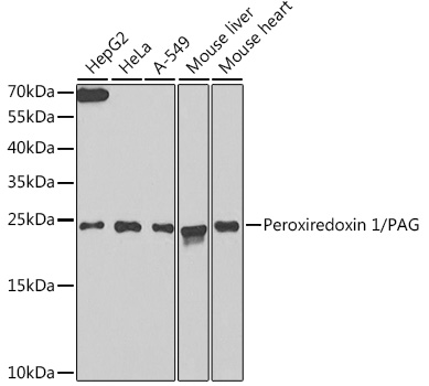 Western blot analysis of extracts of various cell lines using Peroxiredoxin 1/PAG Polyclonal Antibody at 1:1000 dilution.