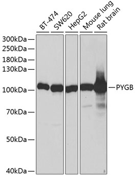 Western blot analysis of extracts of various cell lines using PYGB Polyclonal Antibody at 1:1000 dilution.