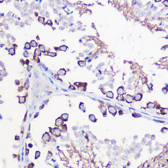 Immunohistochemistry of paraffin-embedded mouse testis using DAZL Polyclonal antibody at dilution of 1:100 (40x lens).Perform high pressure antigen retrieval with 10 mM citrate buffer pH 6.0 before commencing with IHC staining protocol.